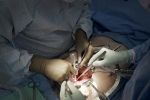 ブタから人への臓器移植が実用化へ新段階、臓器不足解消の切り札となるか　最前線の米国で日本人医師が一翼を担う【ワシントン報告（１１）異種移植の最前線】