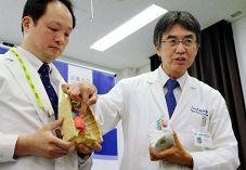 Ｖ部（２２）京都大呼吸器外科教授 伊達洋至（下）　本場で肺移植の腕磨く