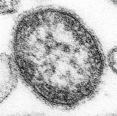 　麻疹ウイルスの電子顕微鏡写真（米疾病対策センター提供）