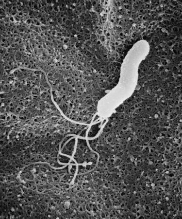 　ピロリ菌の電子顕微鏡写真（大塚製薬提供）
