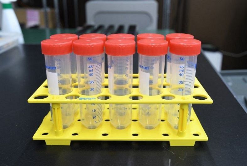 検査 コロナ 唾液 無症状な方を対象にした 新型コロナウイルスの唾液PCR検査
