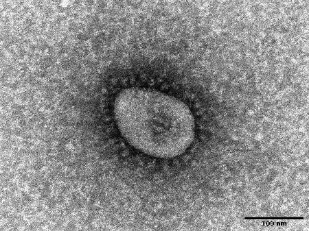 　新型コロナウイルス・オミクロン株の電子顕微鏡写真（国立感染症研究所提供）