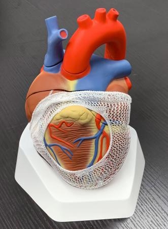 　心臓の模型に装着された矯正ネット（名古屋大提供）