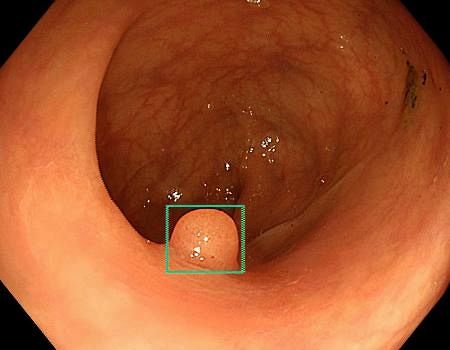 画像が削除されました