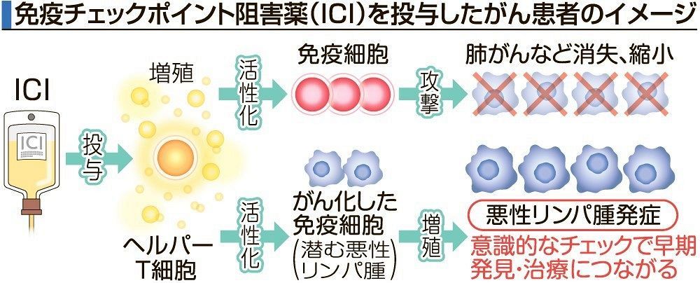 免疫活性化薬で悪性リンパ腫増殖 岡山大冨樫教授らが明らかに 「リスク