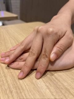 「身体醜形症」、適切な受診へ　満足なき整形反復にリスク　精神科医ら手引作成