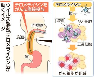 岡山大開発のウイルス製剤、２６年に使用開始の見通し　テロメライシン製造販売を承認申請