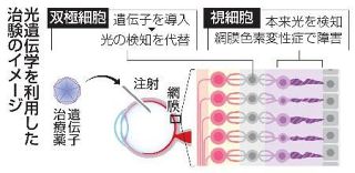 「光遺伝学」で視覚再生　慶応大など、国内初の治験開始