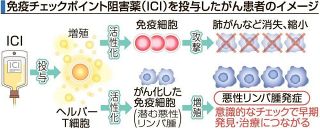 免疫活性化薬で悪性リンパ腫増殖　  岡山大冨樫教授らが明らかに　「リスク認識し早期発見・治療を」
